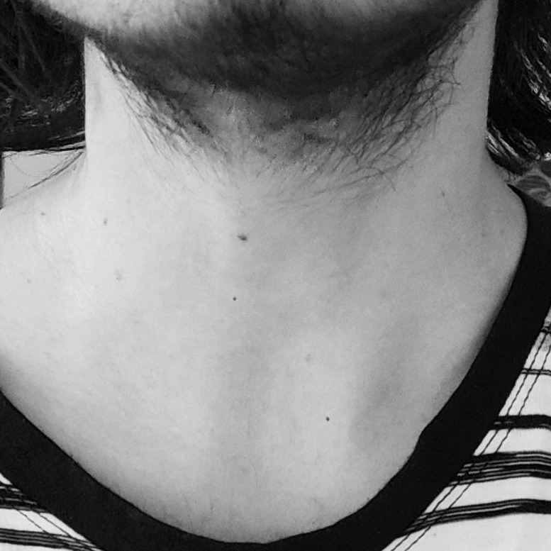 FTMAlex