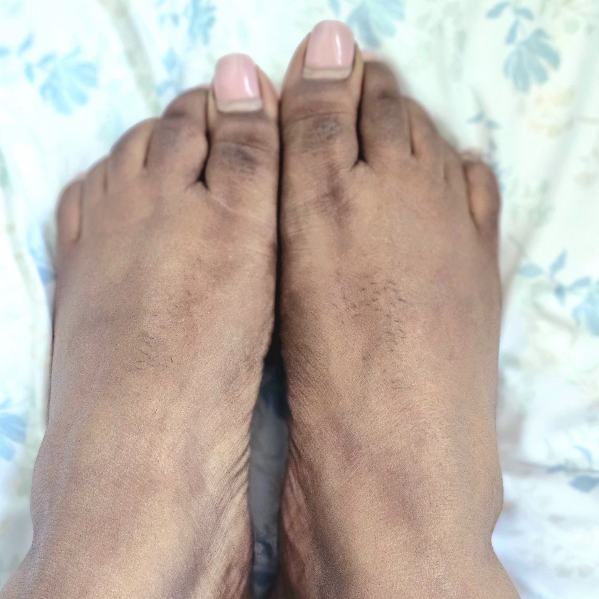 Natural Bare Feet Pics