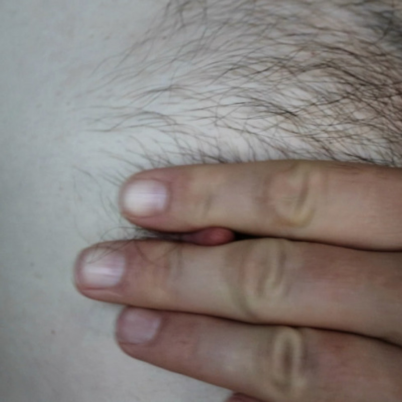 Photoset Hairy Armpits and Nipples