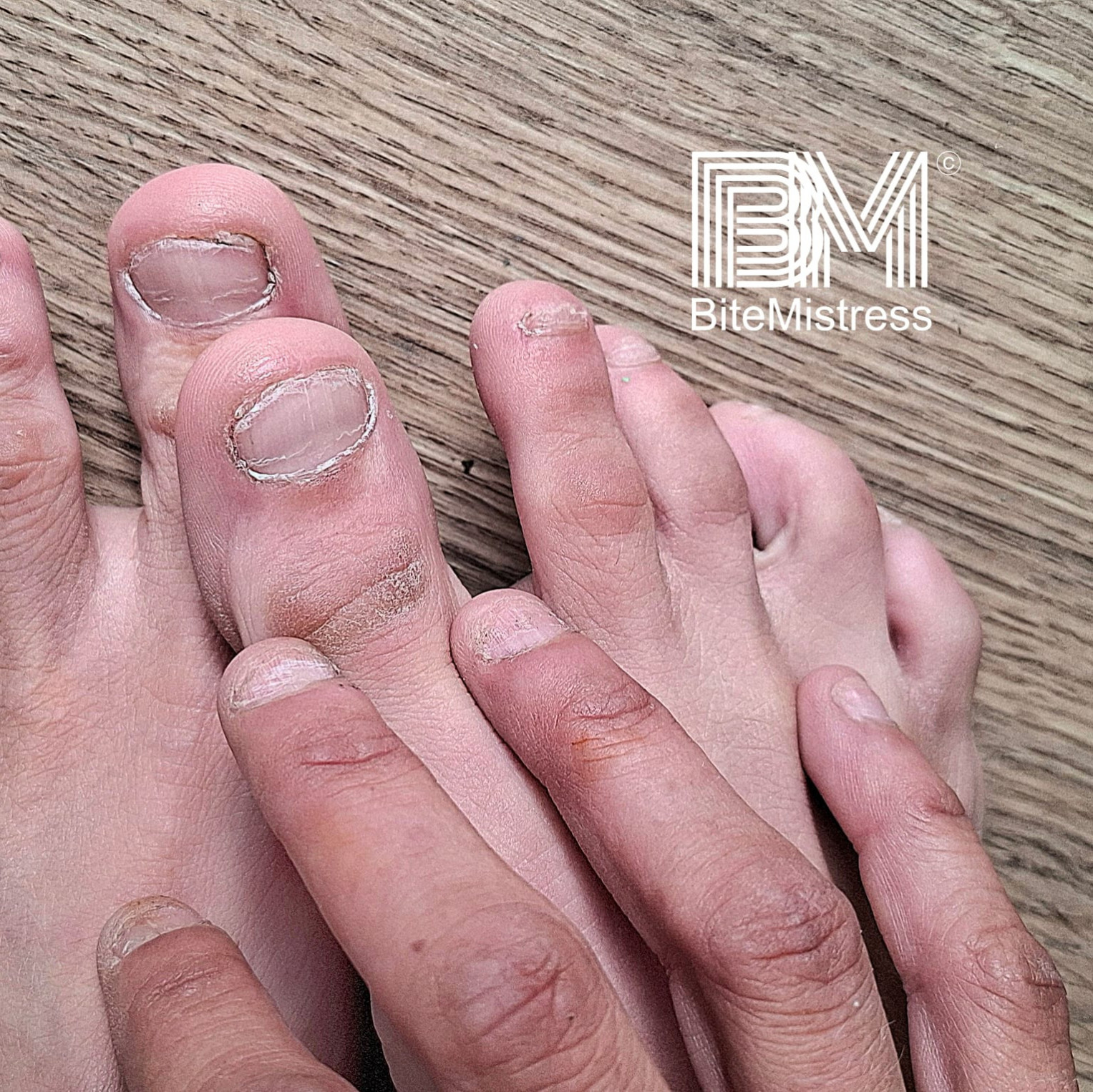 Nail Biting Raw and Bare Hand and Foot Nails