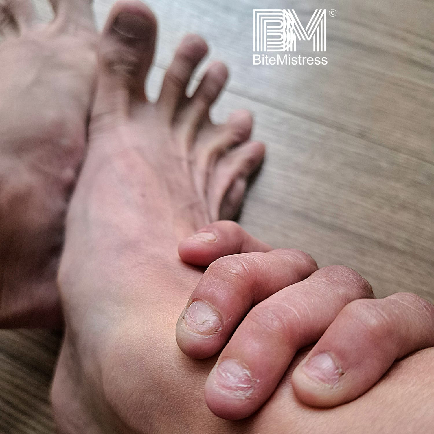 Nail Biting Raw and Bare Hand and Foot Nails