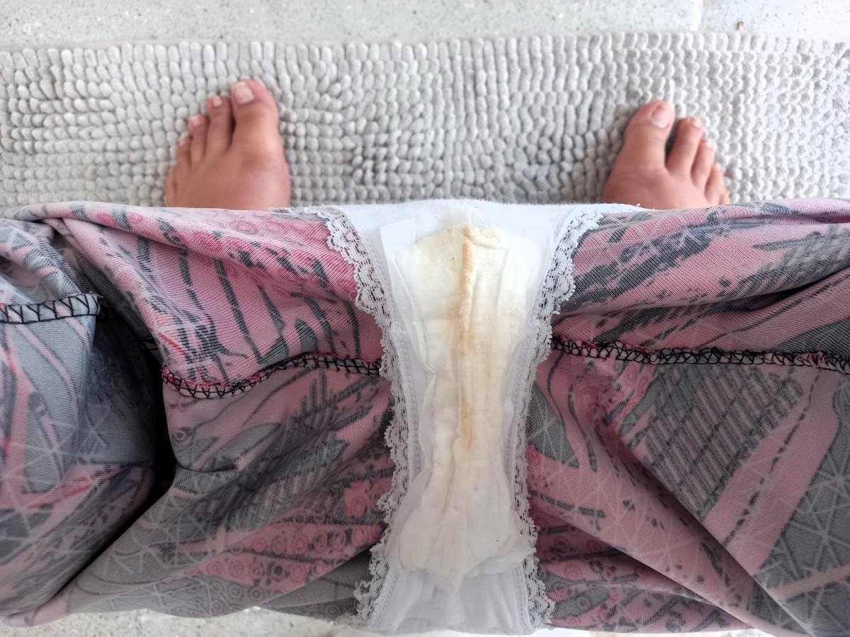 I sell my daily protectors used by days