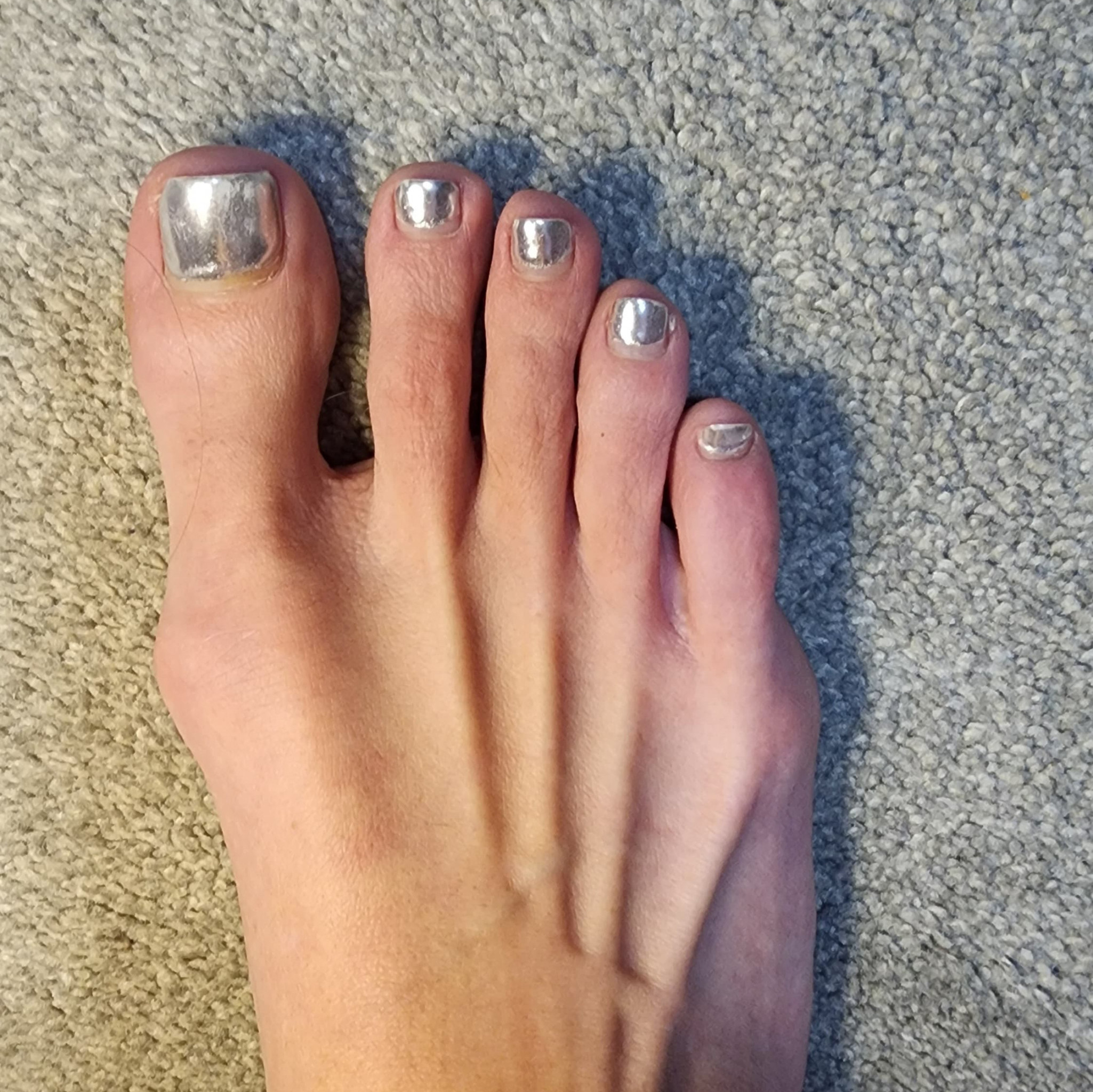 Pedicure  Save my toes!