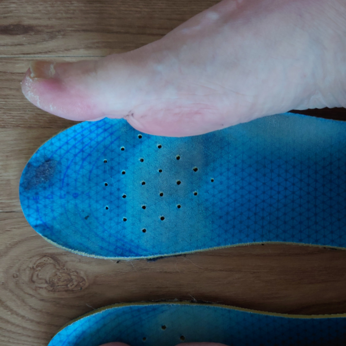 My insoles