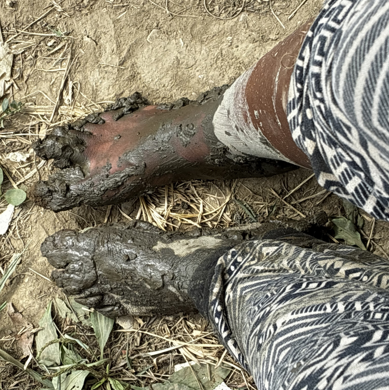 Muddy Feet