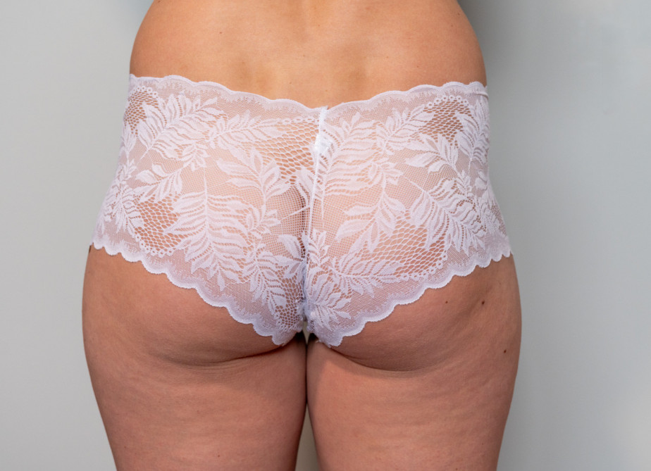 White Lace Boyshorts