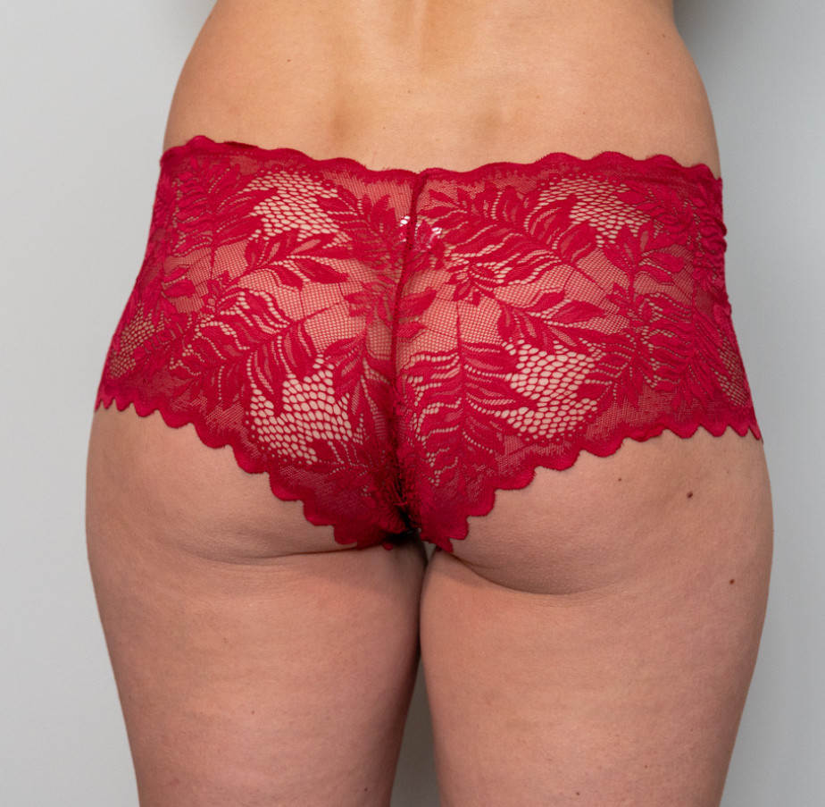 Red Lace Boyshorts