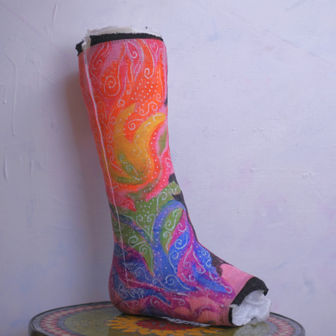 MY FOOT CAST!