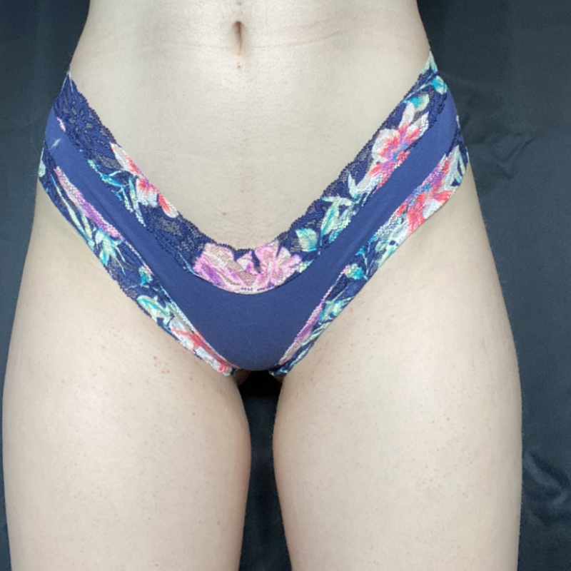 Tropical Lace Cheekster Panty