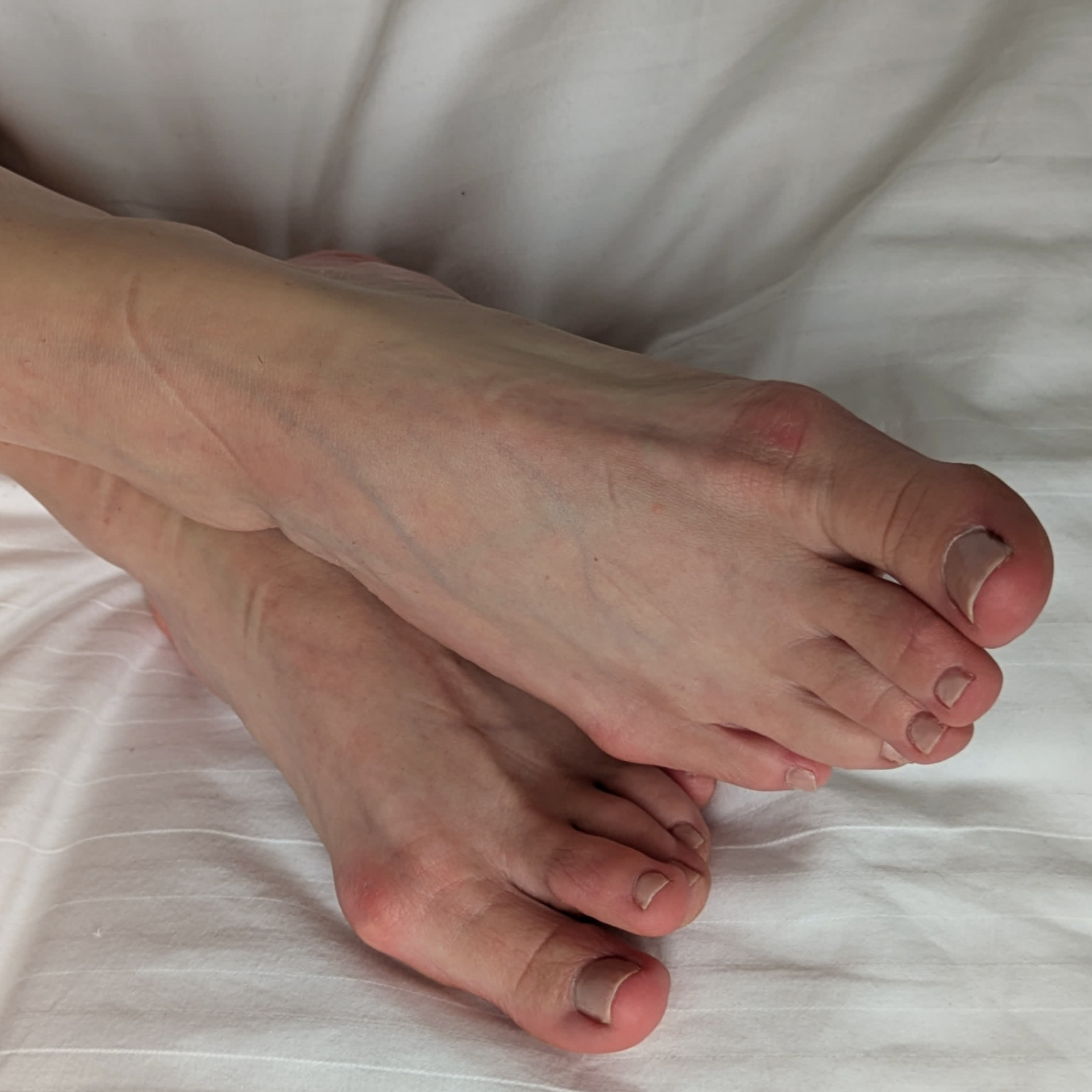 Frilly Flowers Photo Bundle